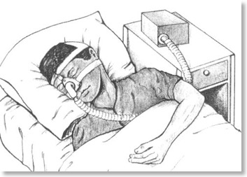 CPAP in Use